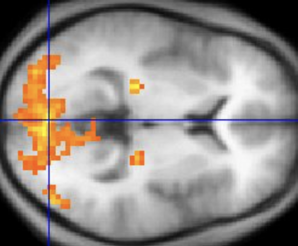 The Science Behind Déjà Vu